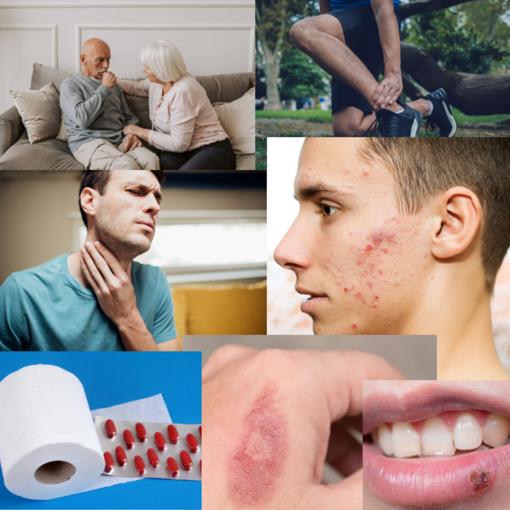 Minor Ailments and Diseases can be treated by a Pharmacist (Ogden Pharmacy). Examples include cough, sports injuries, sore throat, acne, constipation, skin rash, cold sores, and others.