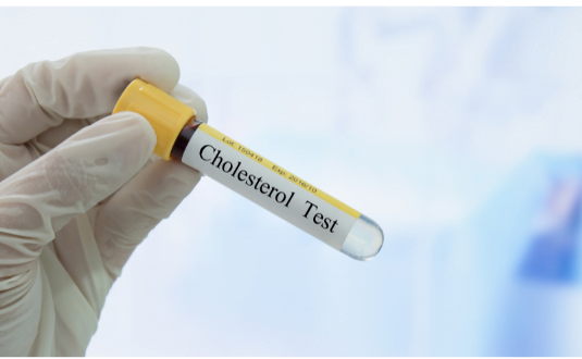 Cholesterol tests should be done periodically to ensure that there is no high cholesterol (Ogden Pharmacy)