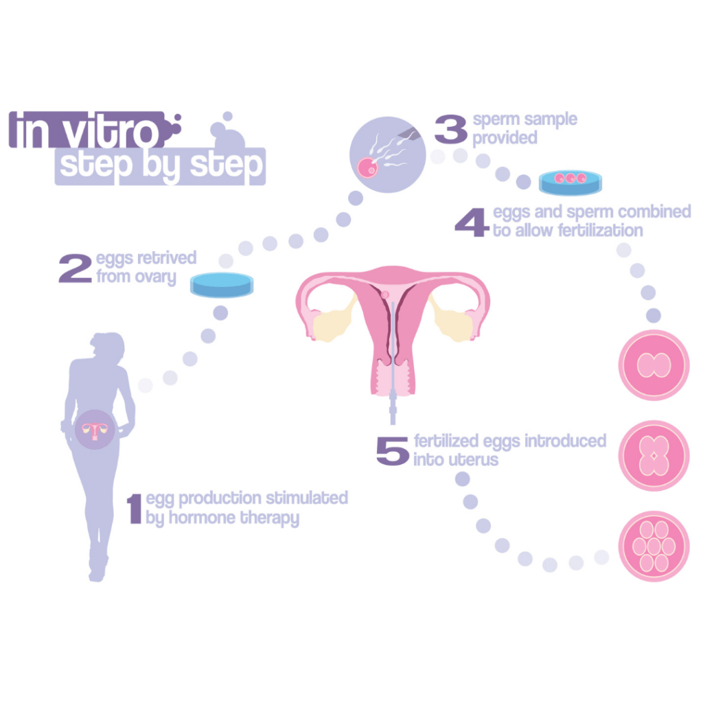 In vitro fertilization step by step.